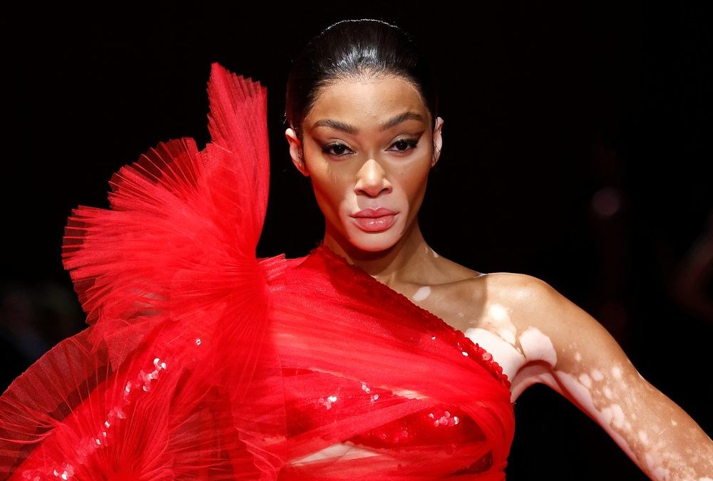 Model Winnie Harlow verkündet Verlobung