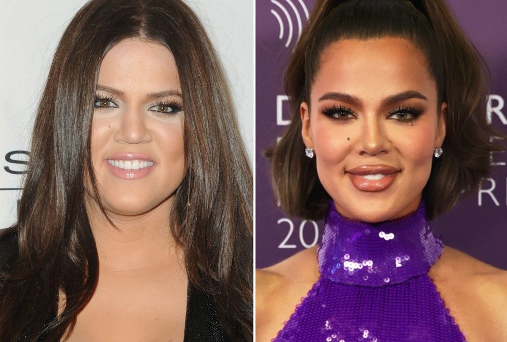 Khloé Kardashian packt über alle Beauty-Eingriffe aus