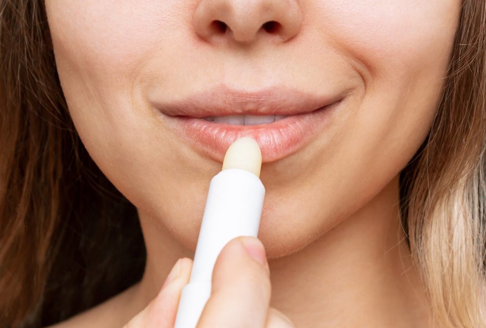Trockene Lippen: Diese Fehler machen sie noch spröder
